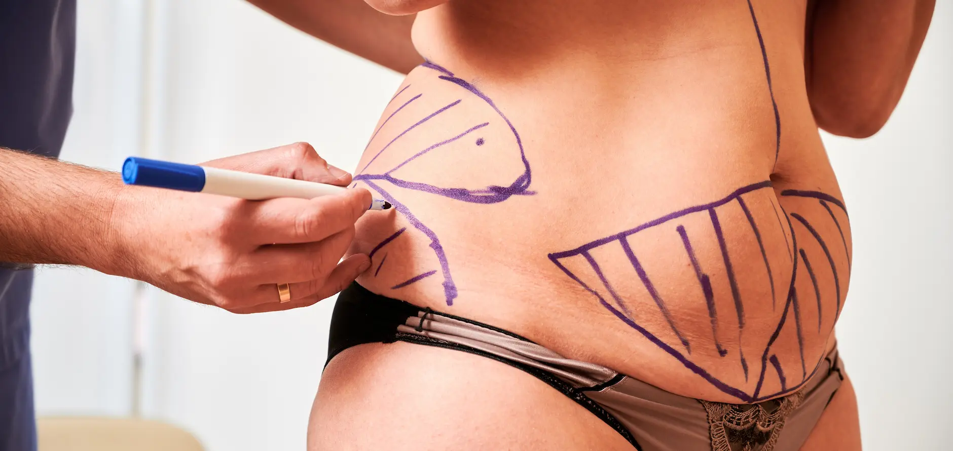 Post-surgical recovery care at Bambu Recovery, Houston TX